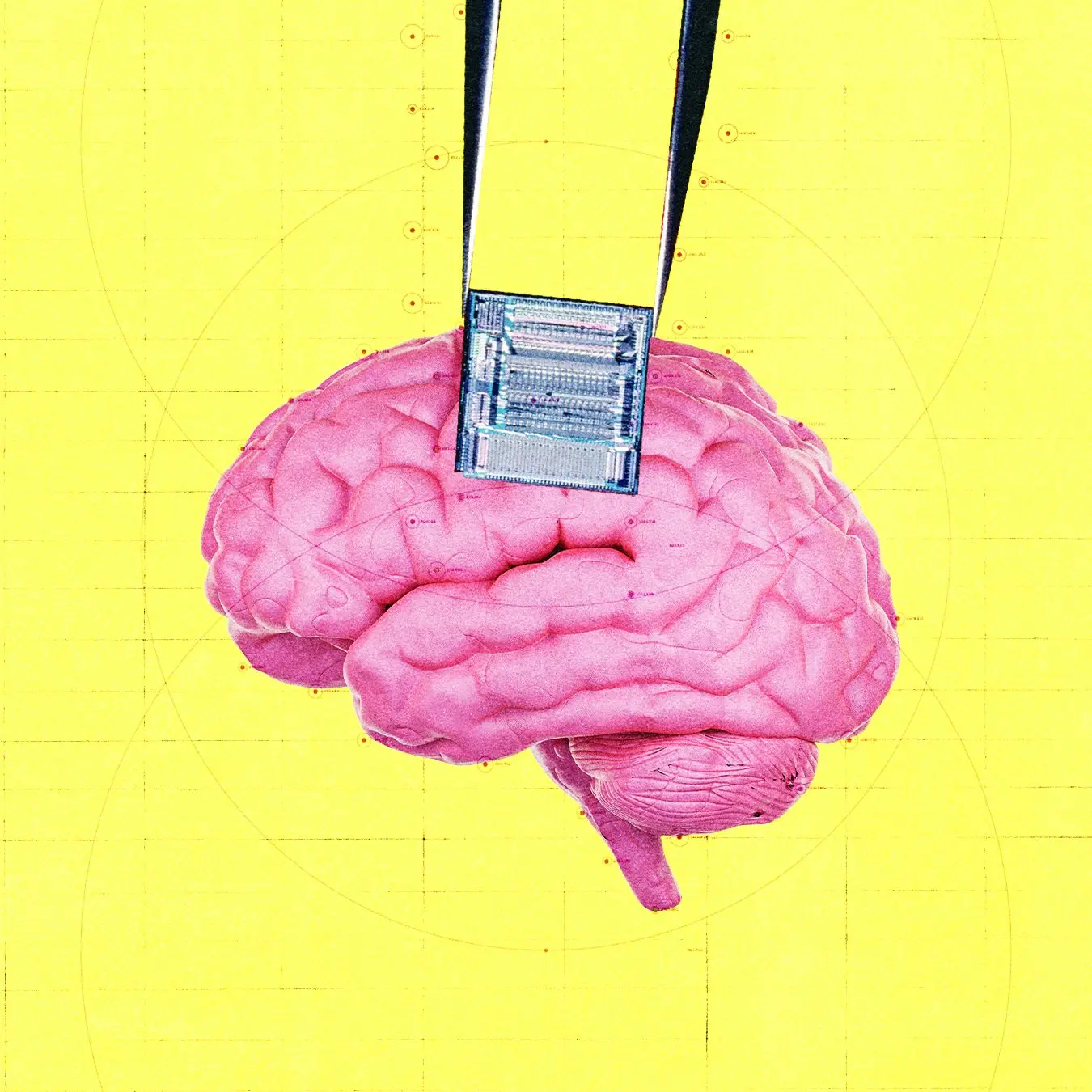 OpenAI investeert in hersenimplantaat dat kanker moet opsporen